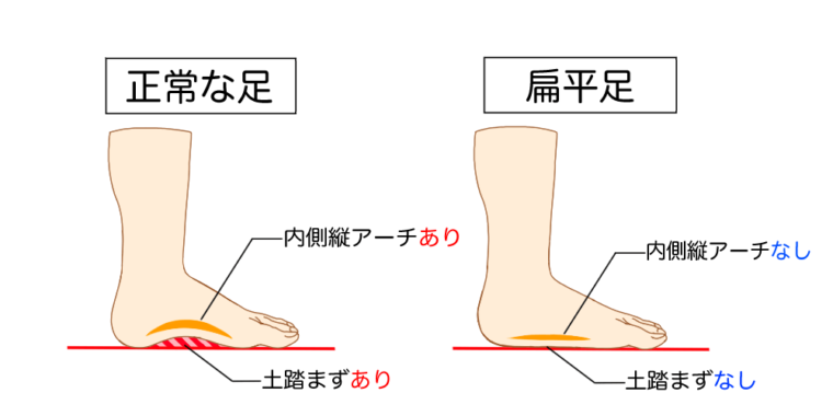 身体の基礎　足